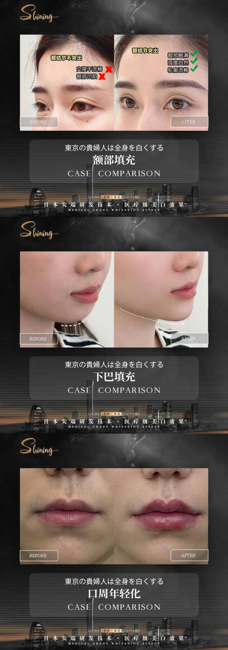 源文件下载【医美黑金案例对比】编号：81840031429364696