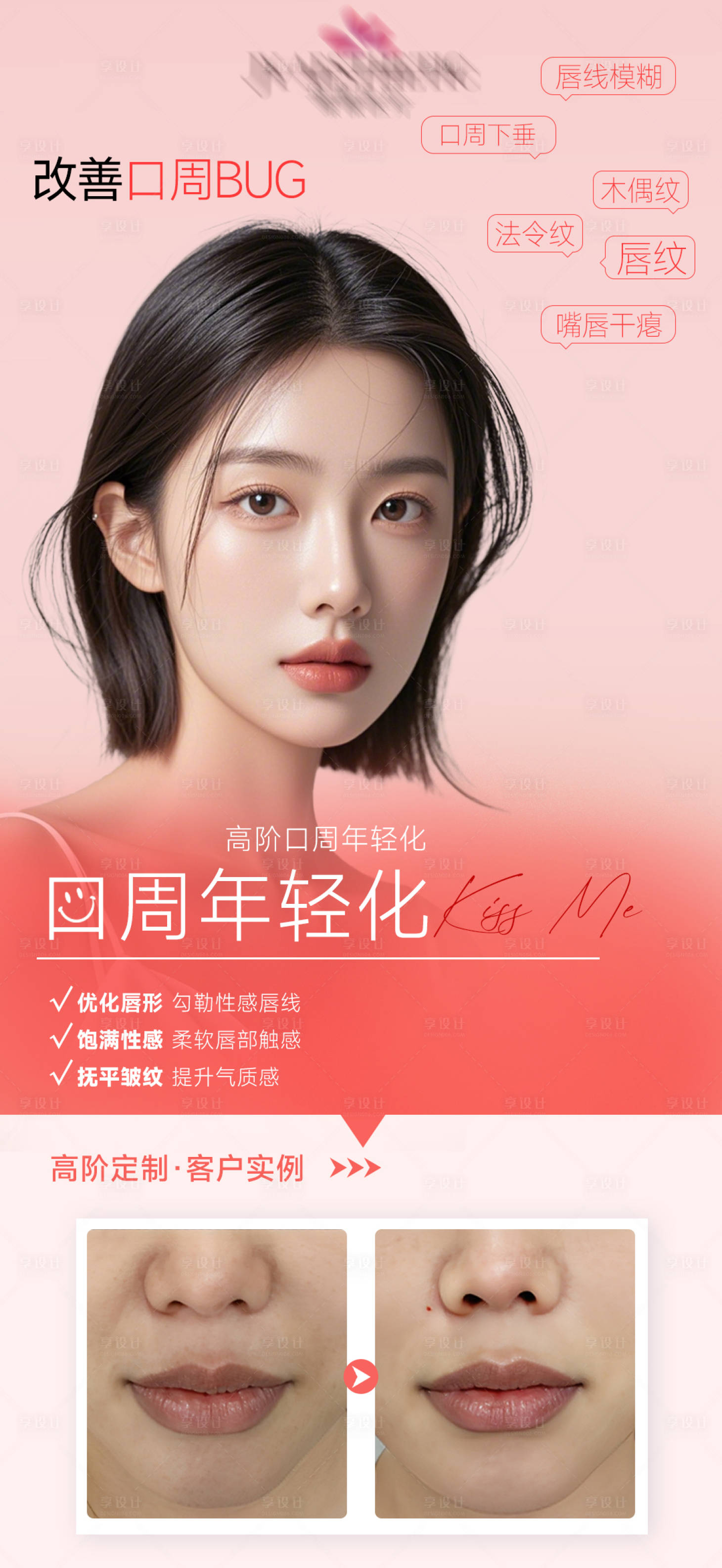 源文件下載【享設計】搜索編號：42920031465629710【口周年輕化醫美宣傳海報】