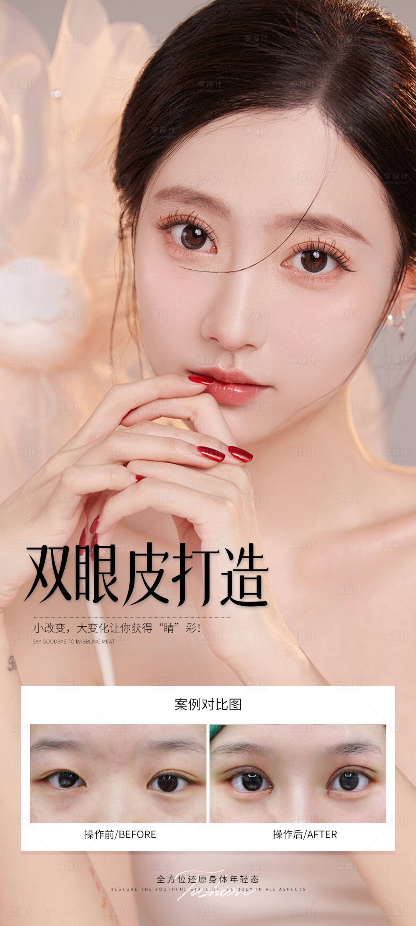 源文件下載【享設計】搜索編號：88730031634094176【雙眼皮打造案例海報】