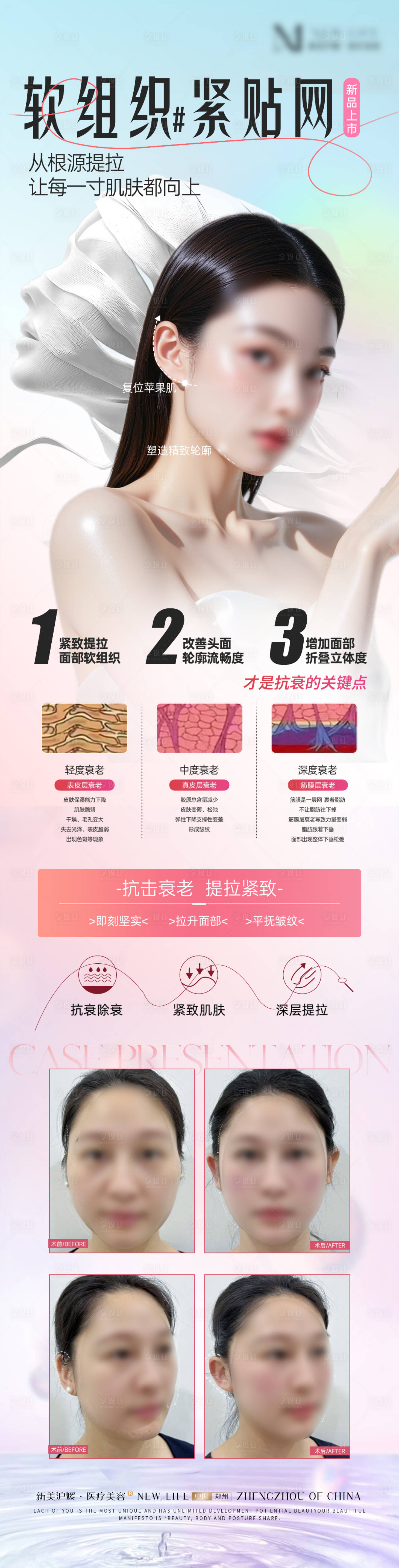 源文件下载【享设计】搜索编号：62430031399564995【医美线雕提升抗衰品相新品海报】