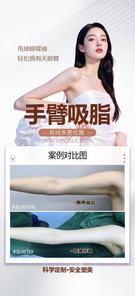 源文件下载【手臂吸脂案例】编号：88710031642094898