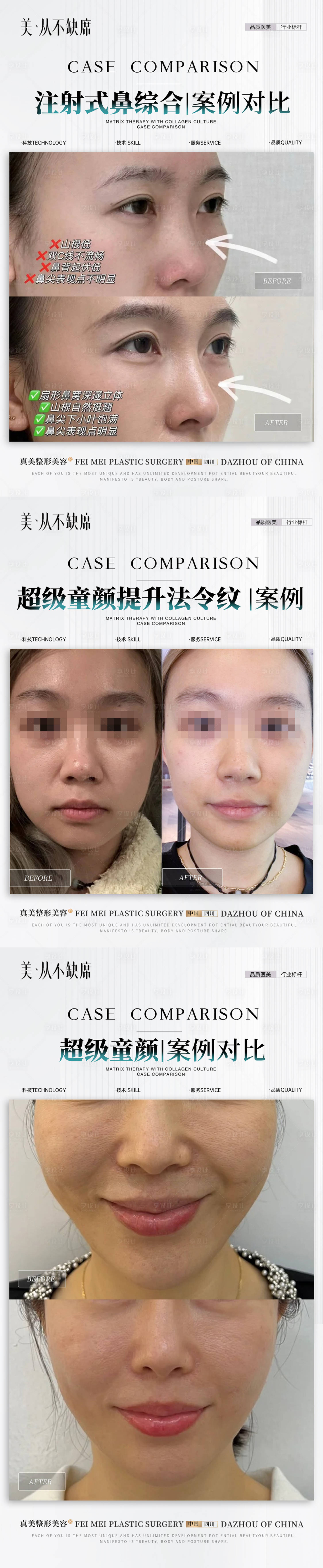 源文件下载【享设计】搜索编号：41360031628899877【医美童颜隆鼻案例】