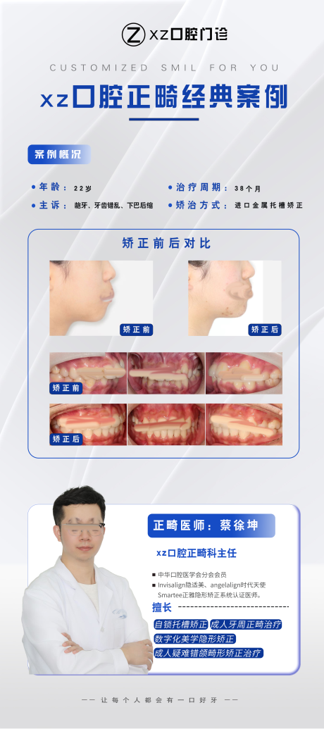 源文件下载【享设计】搜索编号：12250031106652851【正畸案例展架】