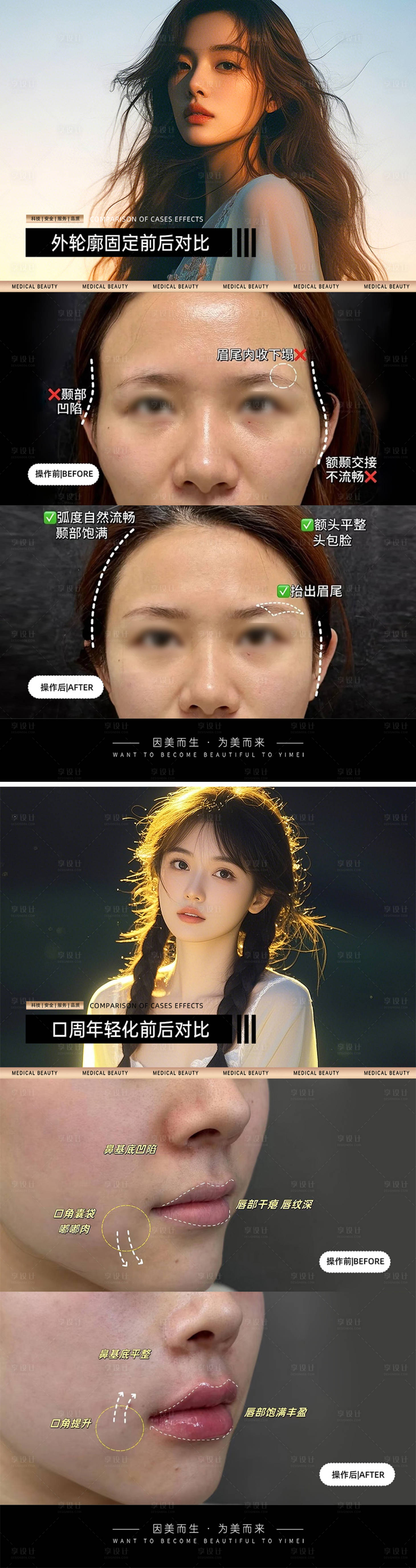 源文件下載【享設計】搜索編號：25840031247775871【醫美案例對比模板】