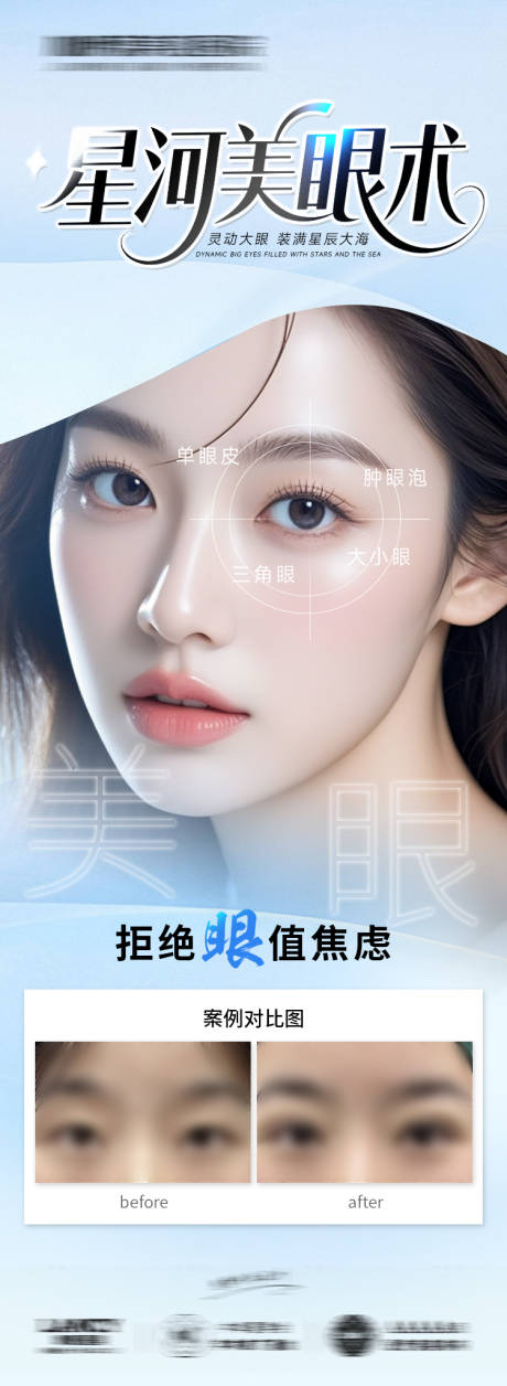 源文件下载【医美海报双眼皮整形】编号：46160031453849099