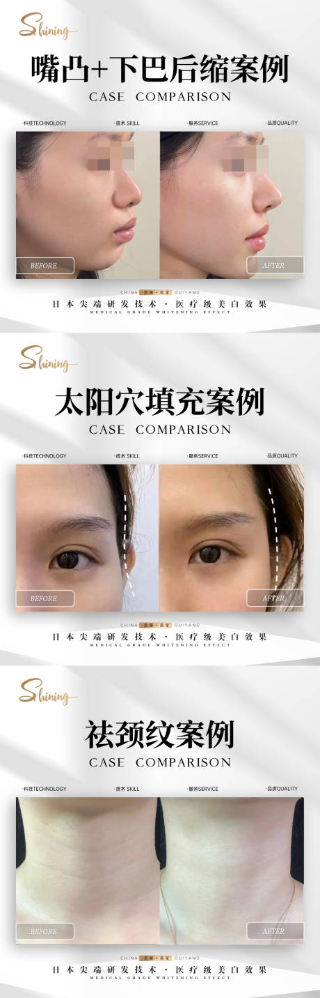 美业案例简约