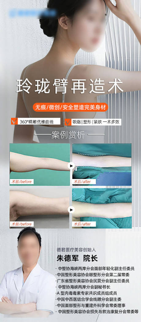 源文件下载【手臂吸脂】编号：37560031641712762