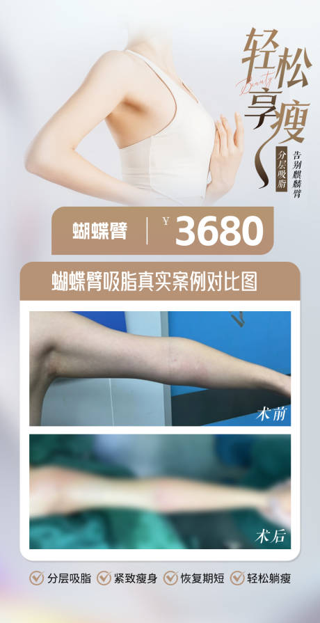 源文件下载【蝴蝶臂 】编号：52810031329952204