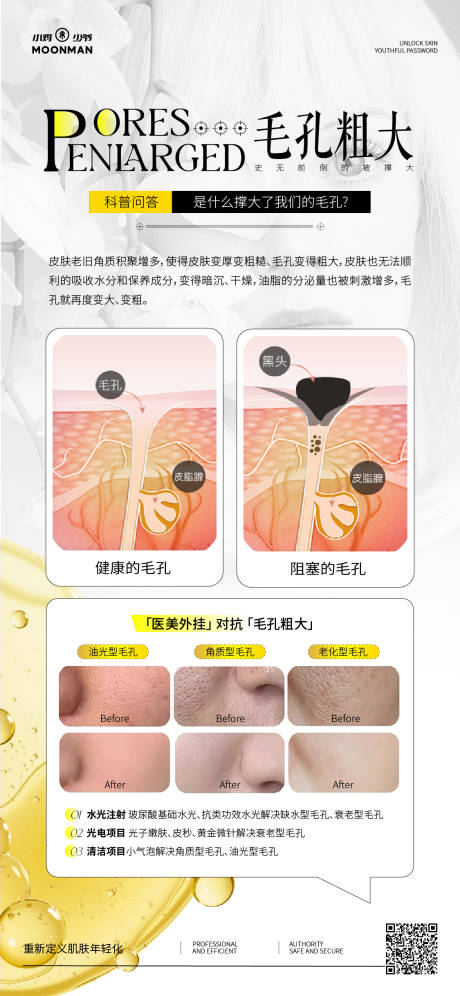 源文件下载【医美科普毛孔粗大科普展架】编号：80840031555352898