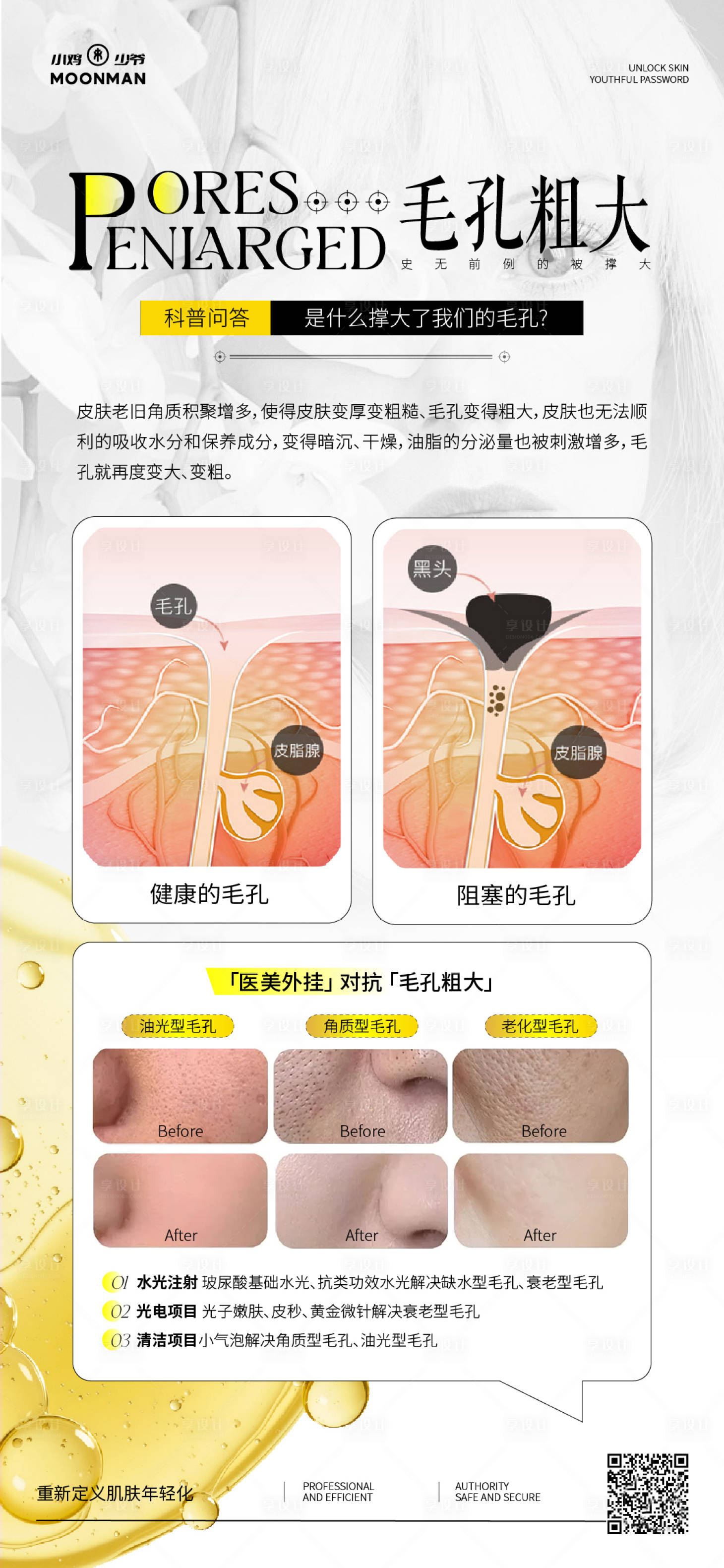 源文件下載【享設計】搜索編號：80840031555352898【醫美科普毛孔粗大科普展架】