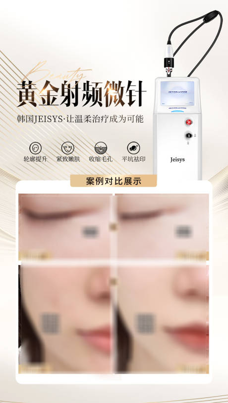 源文件下载【医美黄金射频微针案例海报】编号：87340031223585257