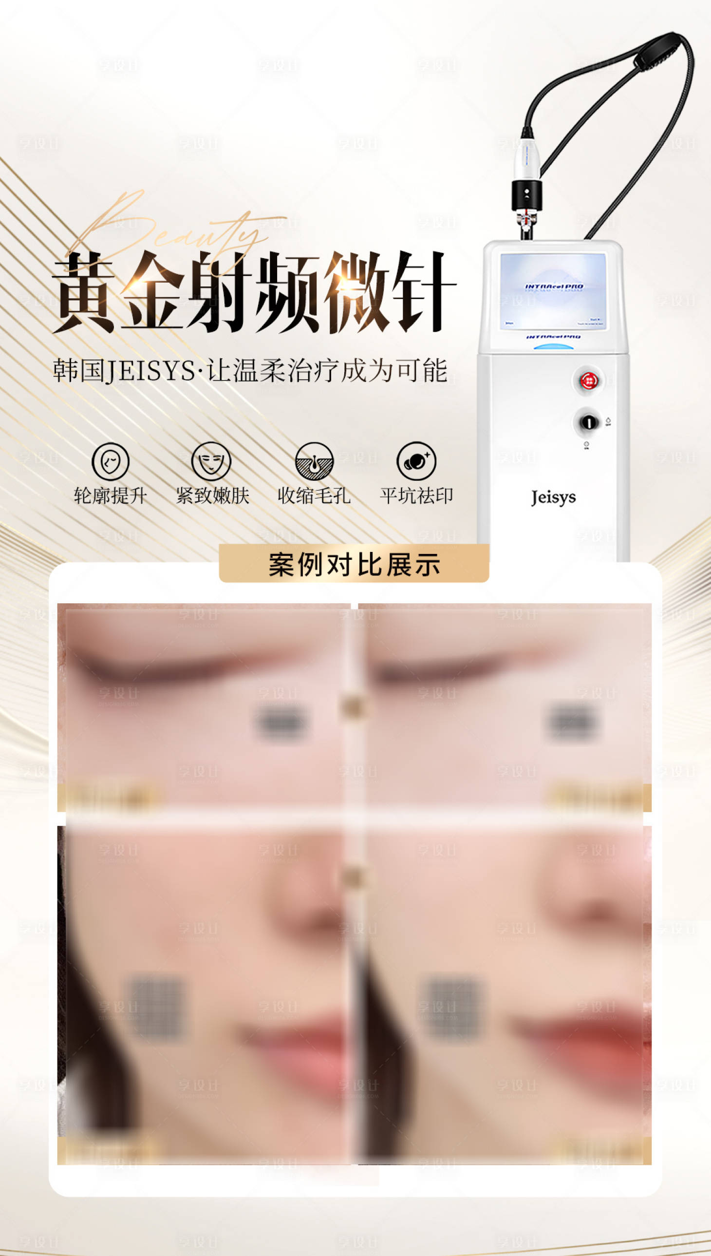 源文件下载【享设计】搜索编号：87340031223585257【医美黄金射频微针案例海报】