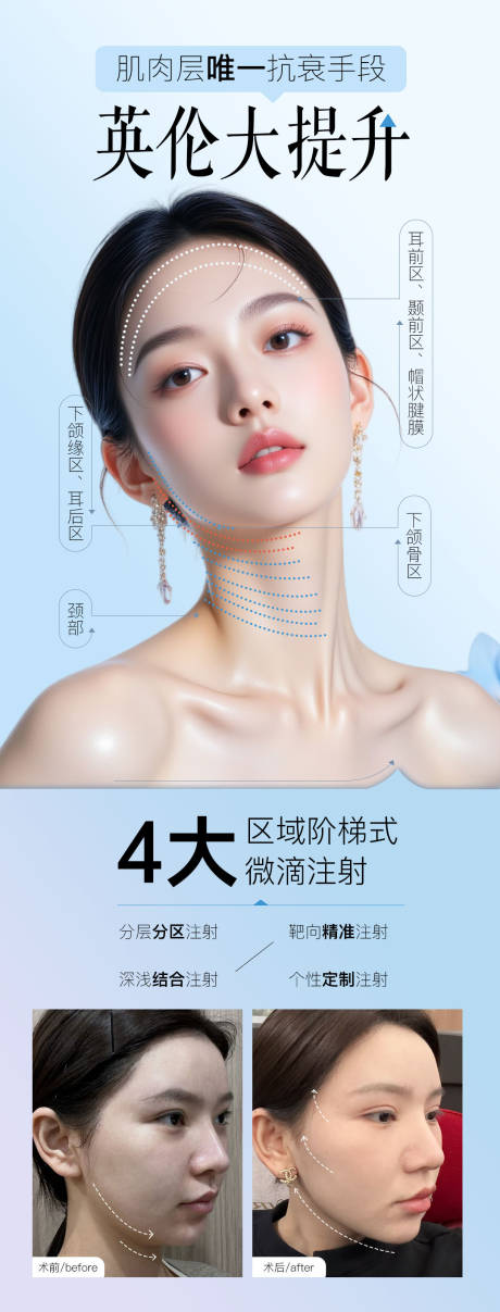 源文件下载【英伦大提升医美整形海报】编号：14880031579503858