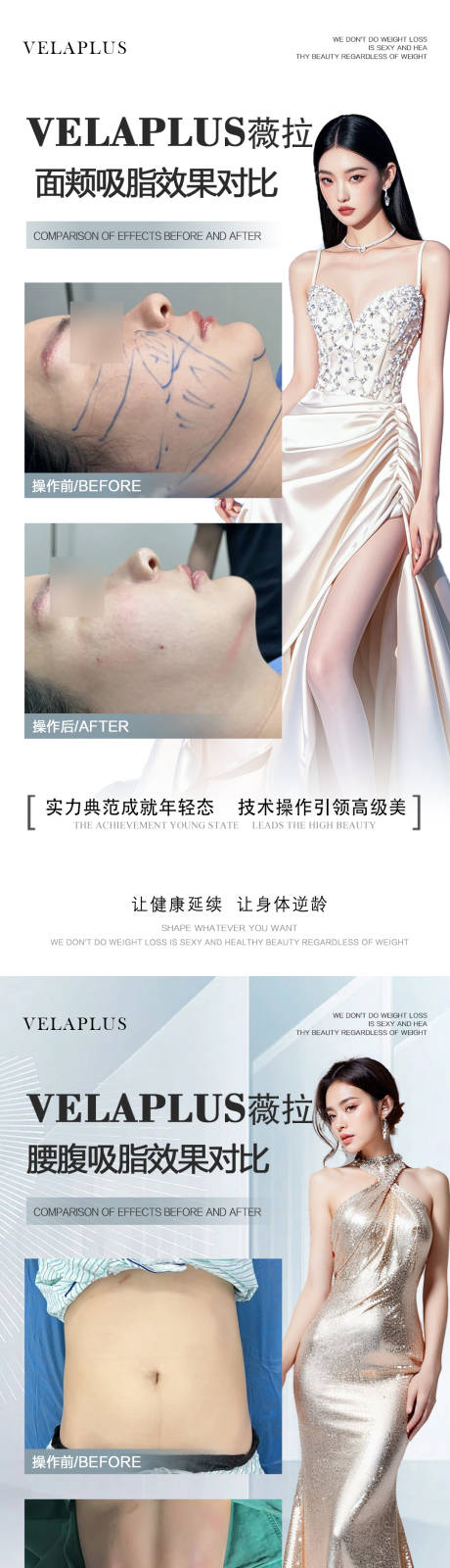 源文件下载【面颊腰腹吸脂案例】编号：49320031249608738