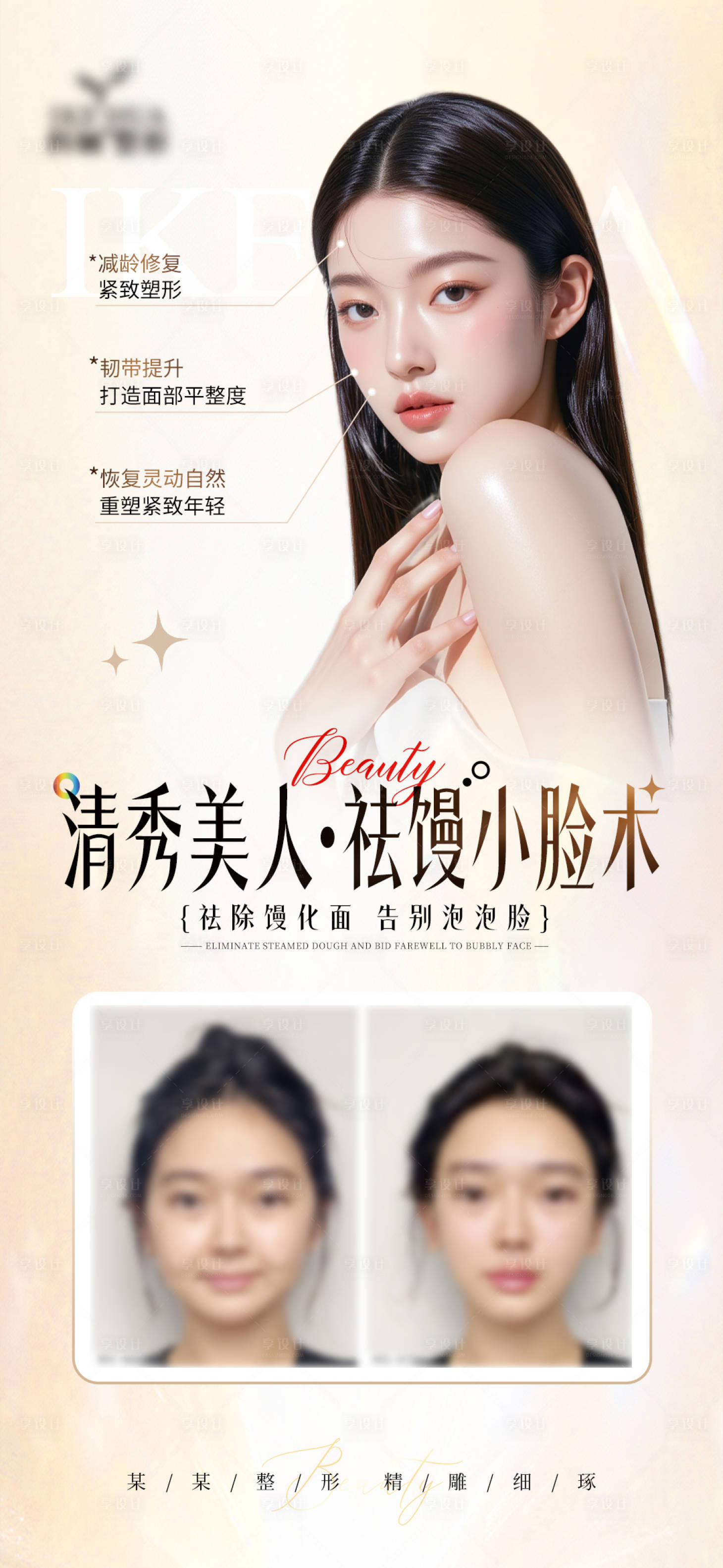 源文件下載【享設計】搜索編號：99060031186578580【淺金色祛饅化案例淺色高級宣傳海報】