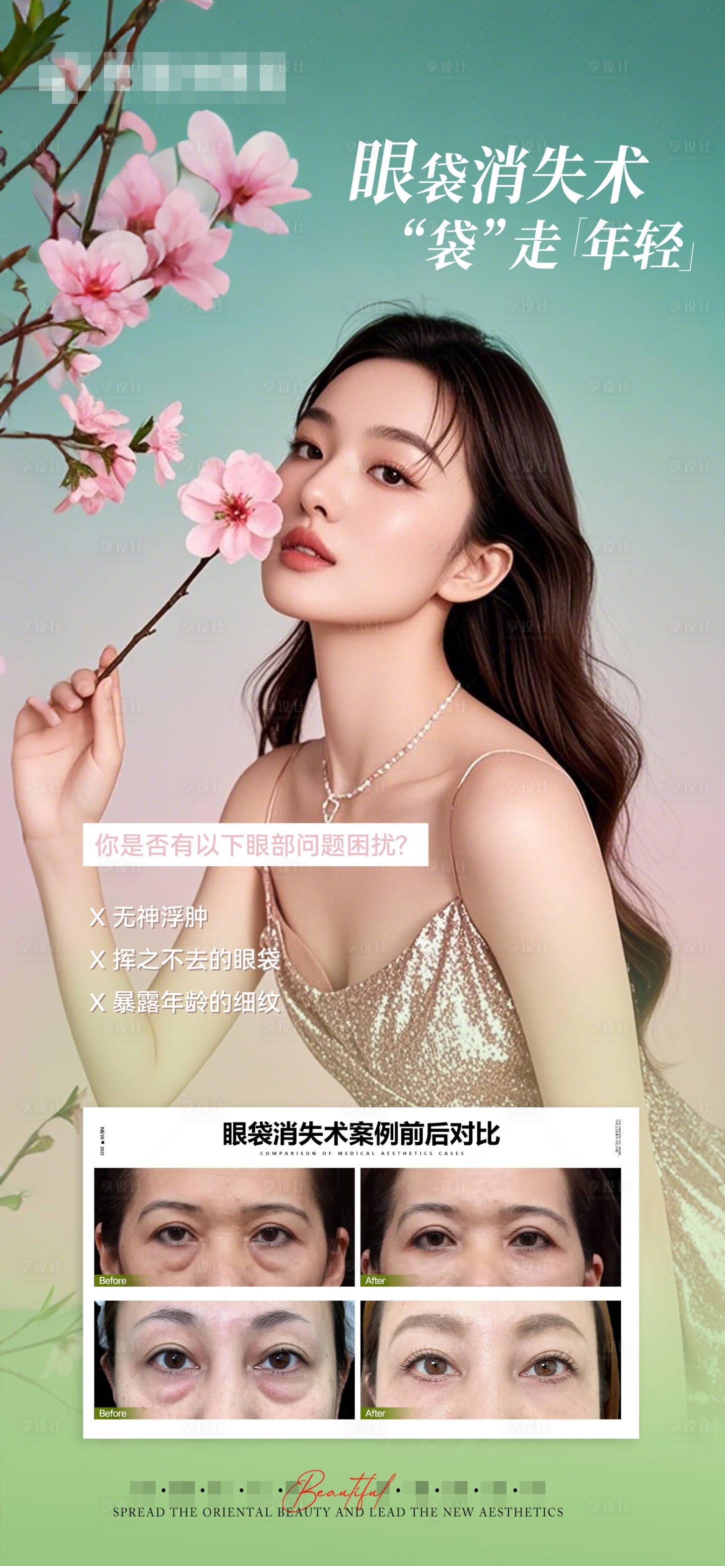 源文件下载【享设计】搜索编号：53200031164015625【医美祛眼袋对比宣传海报】