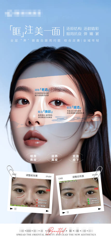源文件下載【享設(shè)計(jì)】搜索編號(hào)：70060031186618443【醫(yī)美眼周抗衰宣傳對(duì)比海報(bào)】