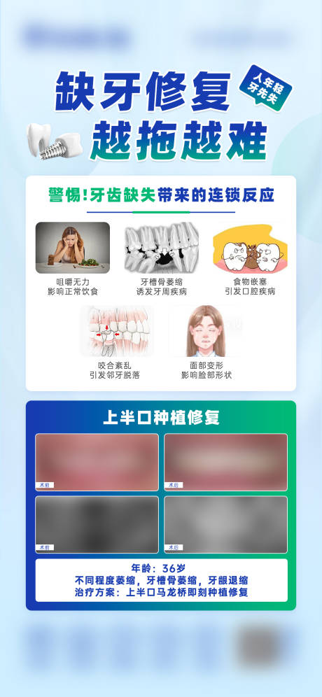 源文件下载【缺牙修复科普案例海报】编号：73370031578968487