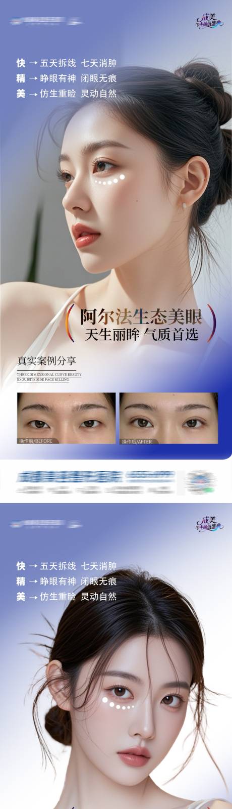 源文件下载【医美阿尔法生态美眼案例 】编号：29050031223187414