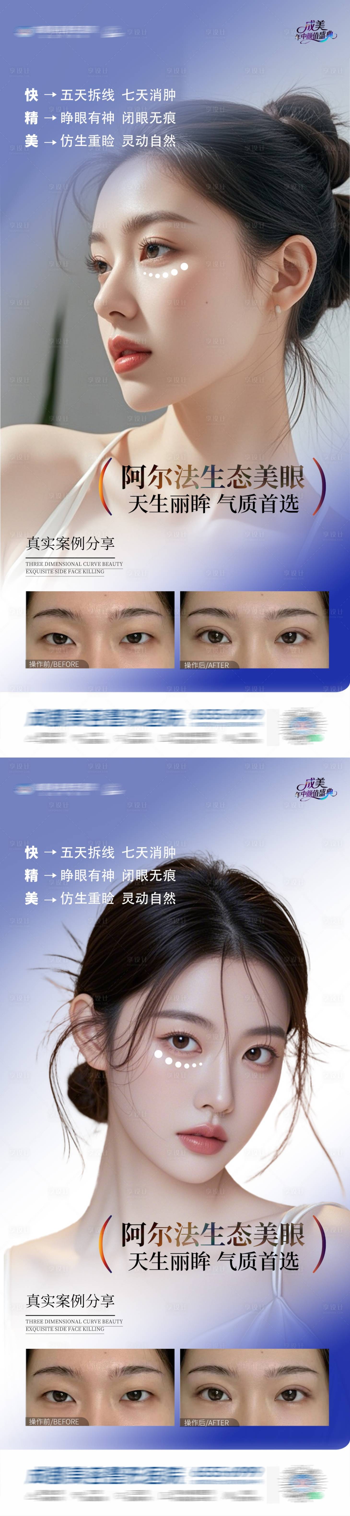 源文件下载【享设计】搜索编号：29050031223187414【医美阿尔法生态美眼案例 】