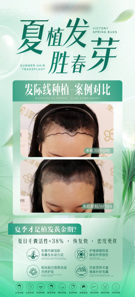 源文件下載【醫美夏季植發案例對比海報】編號：76880031401713781