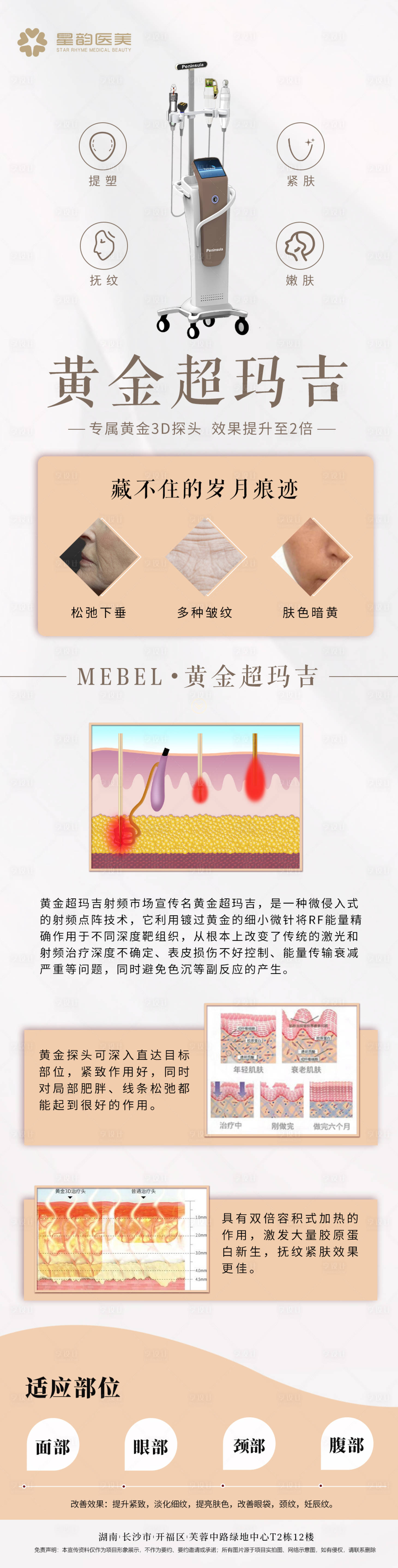 源文件下载【享设计】搜索编号：92220031547633108【黄金微针科普长图】