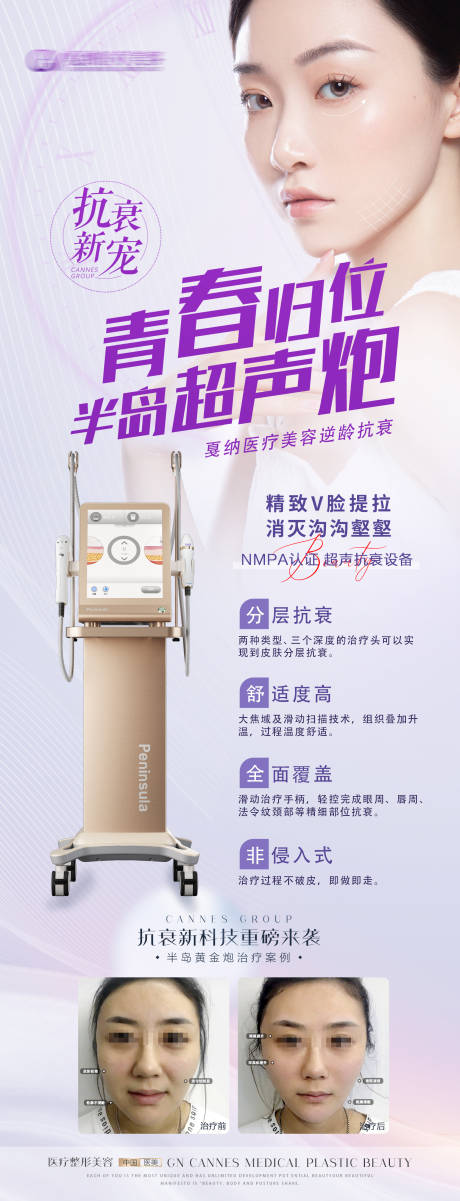 源文件下載【享設計】搜索編號：23120031509175927【醫美皮膚科半島超聲炮科普海報】