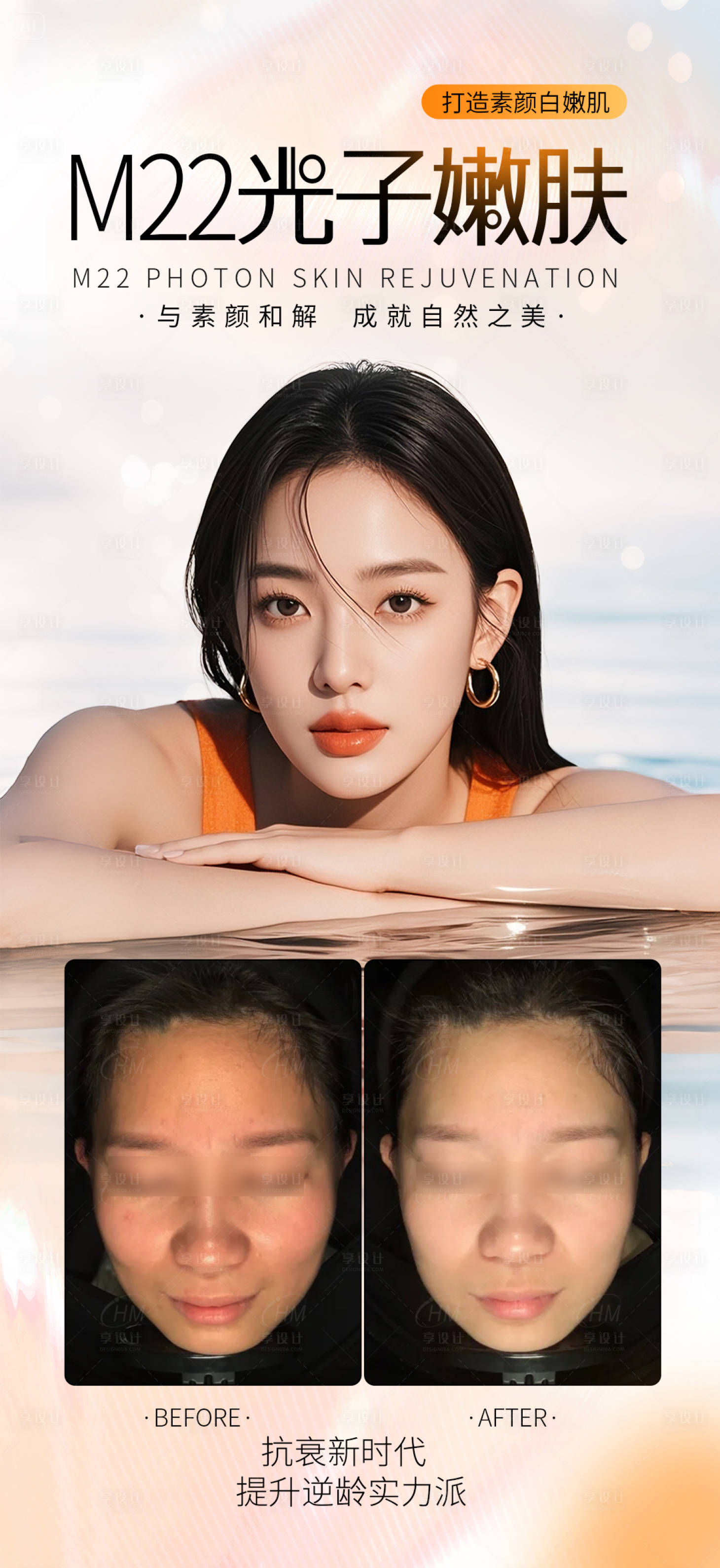 源文件下载【享设计】搜索编号：53360031181223304【医美光子嫩肤案例海报】