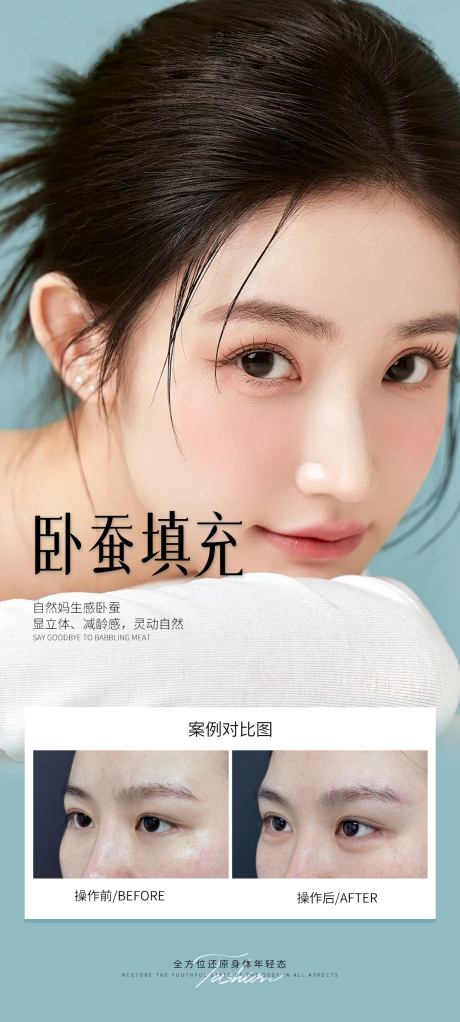 源文件下載【享設計】搜索編號：72890031151919301【醫美臥蠶填充案例海報】