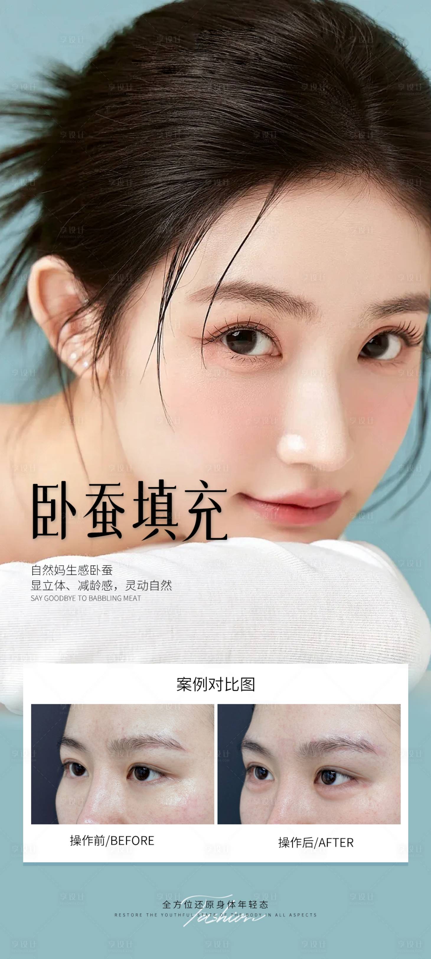 源文件下载【享设计】搜索编号：72890031151919301【医美卧蚕填充案例海报】