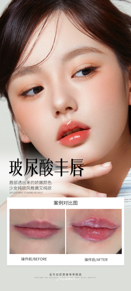 医美玻尿酸丰唇案例海报