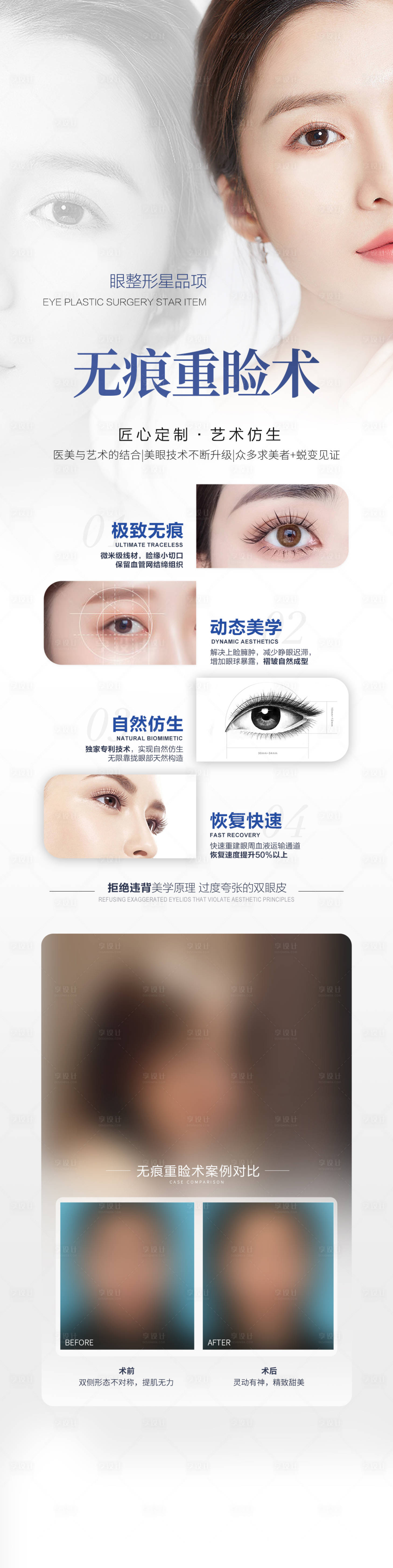 源文件下載【享設計】搜索編號：50880031207927055【無痕重瞼術宣傳海報】
