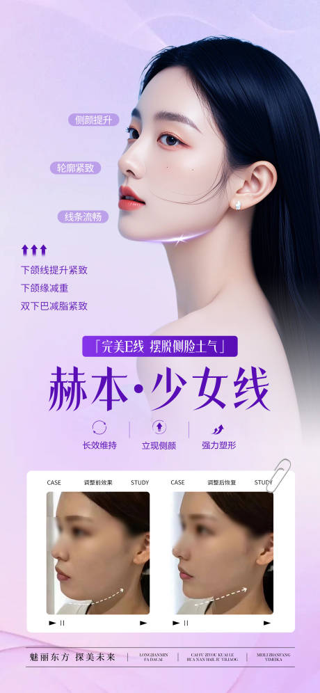 源文件下载【医美赫本少女线宣传海报】编号：29530031255124279
