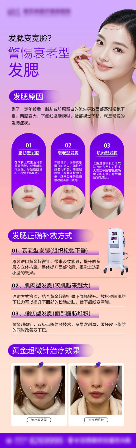 源文件下載【享設計】搜索編號：88900031553009456【思嘉麗黃金超微針宣傳】