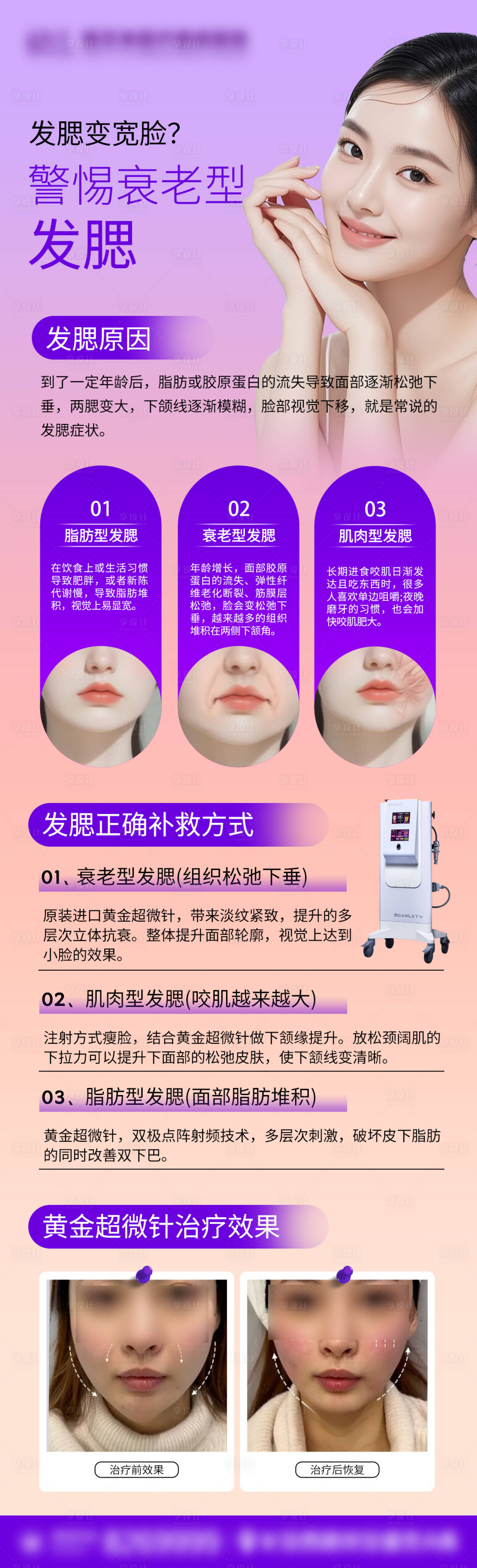 源文件下載【享設計】搜索編號：88900031553009456【思嘉麗黃金超微針宣傳】