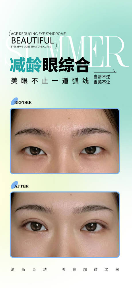 源文件下载【减龄眼综合案例海报】编号：53940031180704435