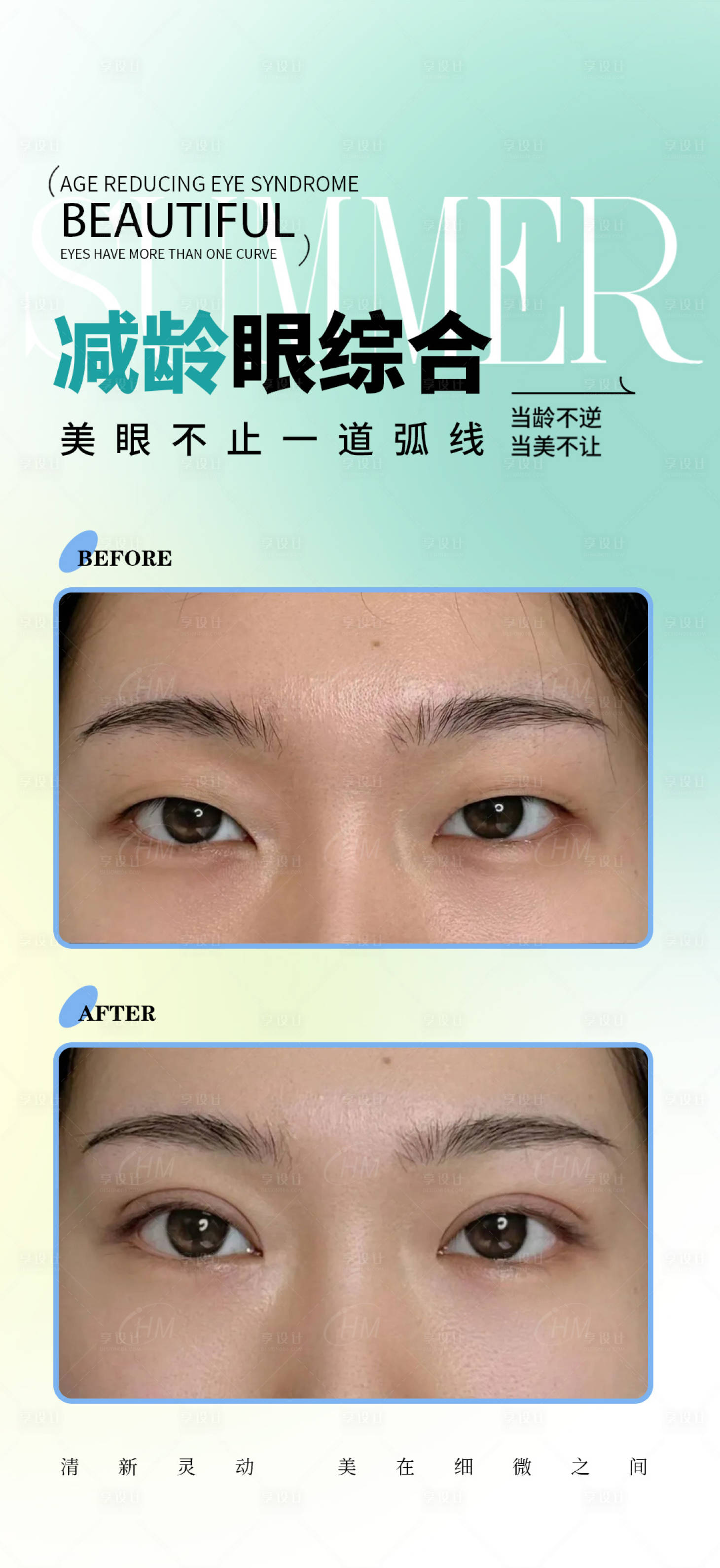 源文件下載【享設計】搜索編號：53940031180704435【減齡眼綜合案例海報】