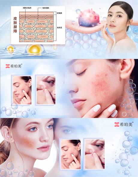 源文件下载【享设计】搜索编号：31540031242679570【皮肤管理轮播图】