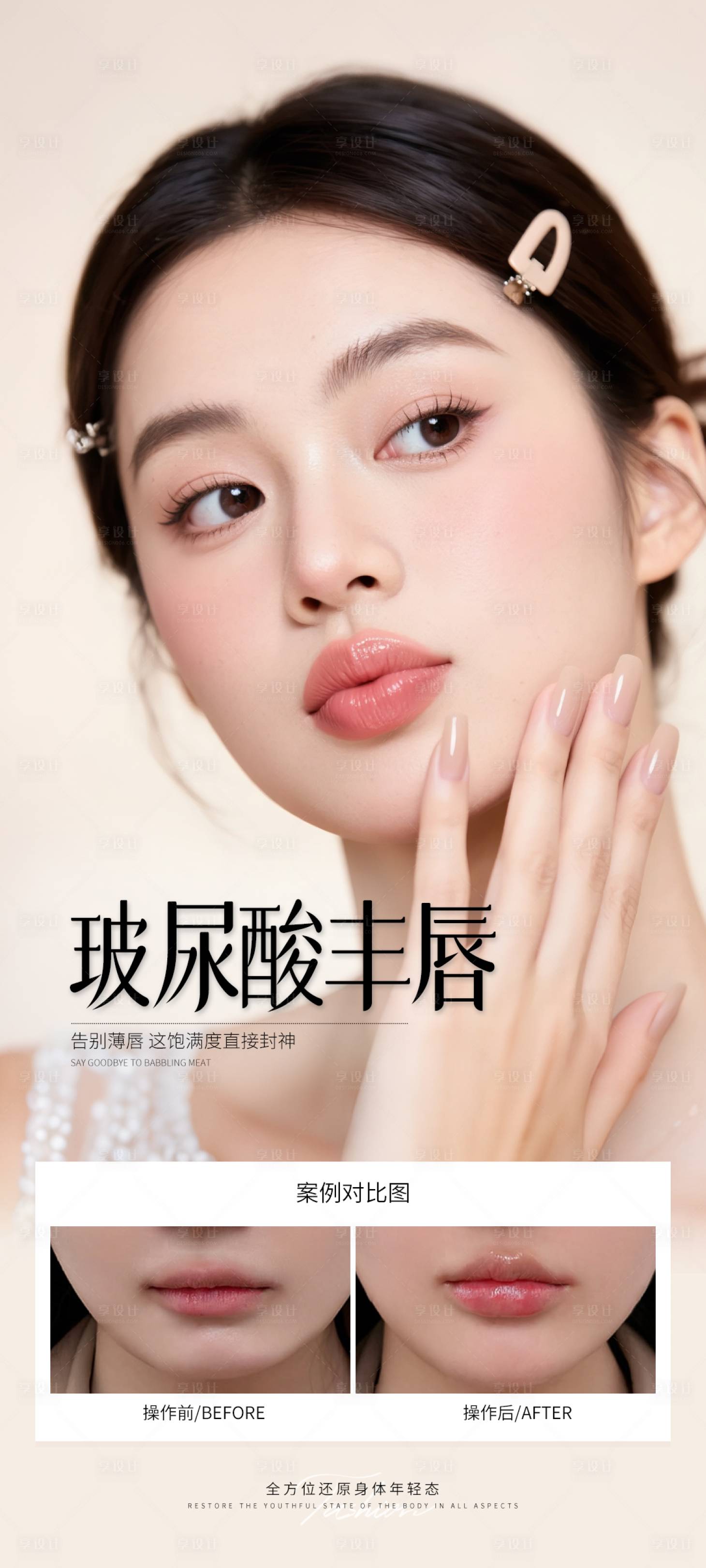 源文件下载【享设计】搜索编号：82690031571892410【玻尿酸丰唇案例海报】