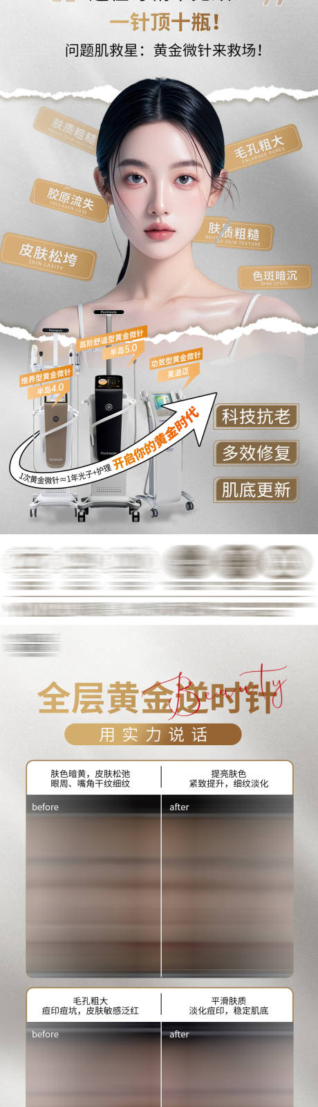源文件下载【黄金微针】编号：16690031598109256