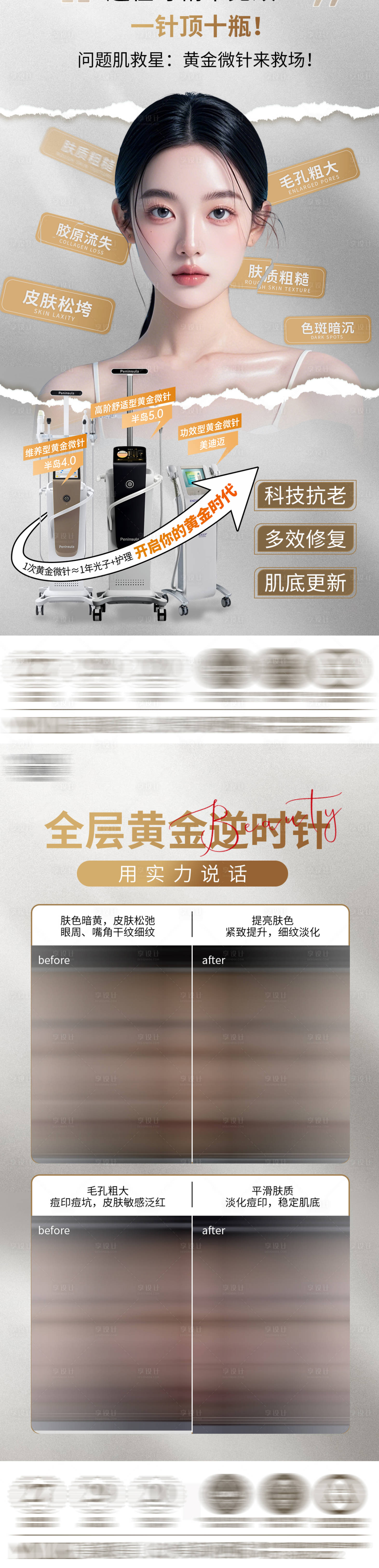 源文件下载【享设计】搜索编号：16690031598109256【黄金微针】