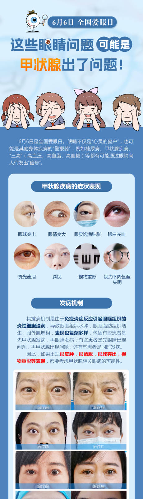 源文件下载【世界爱眼日】编号：65870031267727545