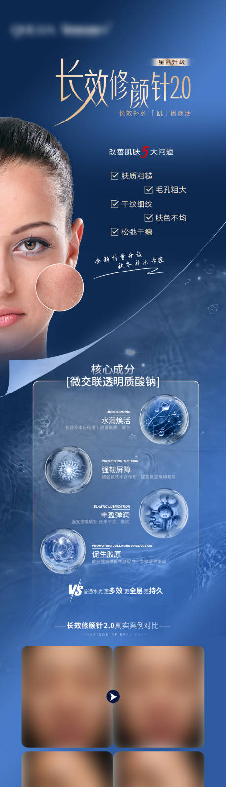 透明质酸钠长图海报