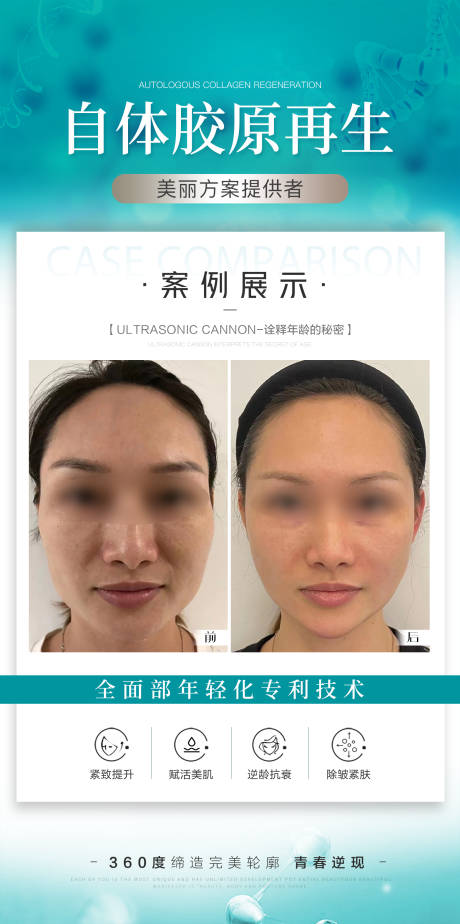 源文件下载【医美案例海报】编号：26730031479467997