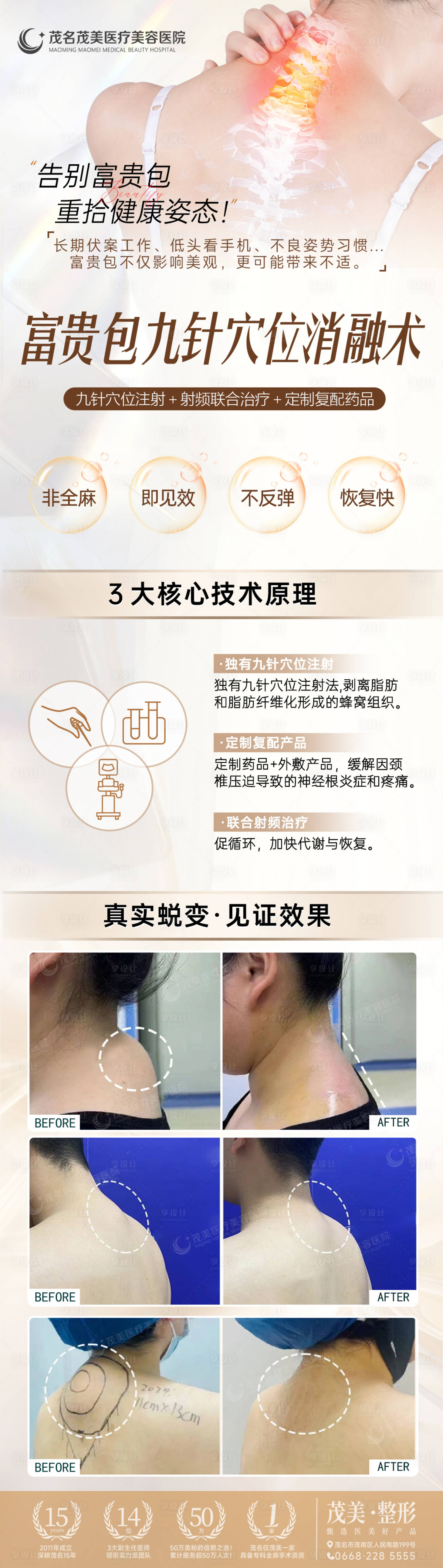 源文件下载【享设计】搜索编号：50050031302293765【富贵包技术九针穴位长图海报】