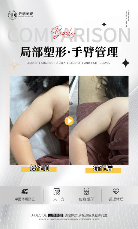 源文件下載【醫(yī)美手臂管理案例對(duì)比海報(bào)】編號(hào)：31030031247804057