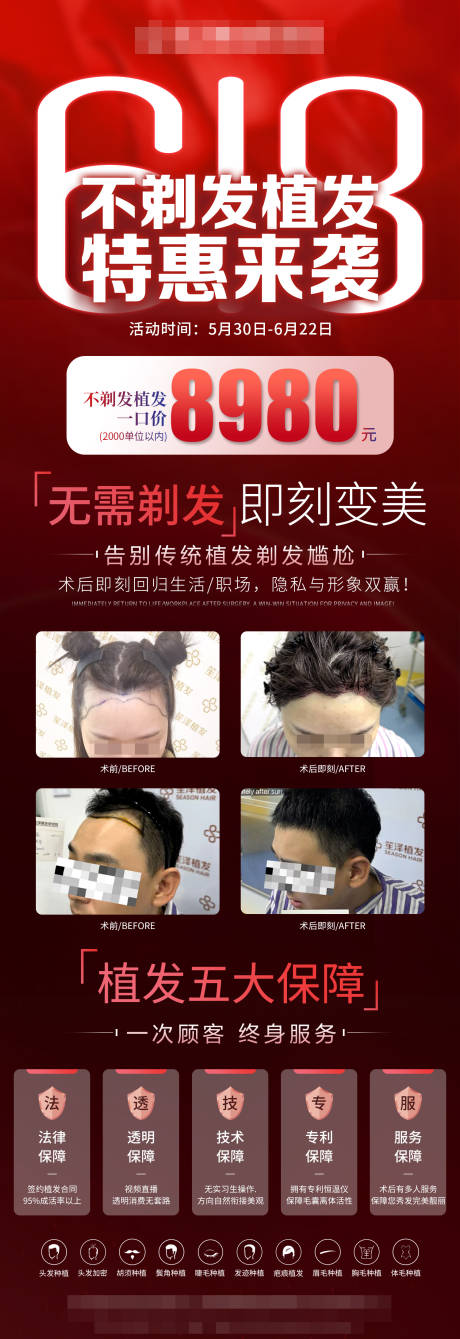 源文件下载【医美618植发活动海报】编号：37360031165017063