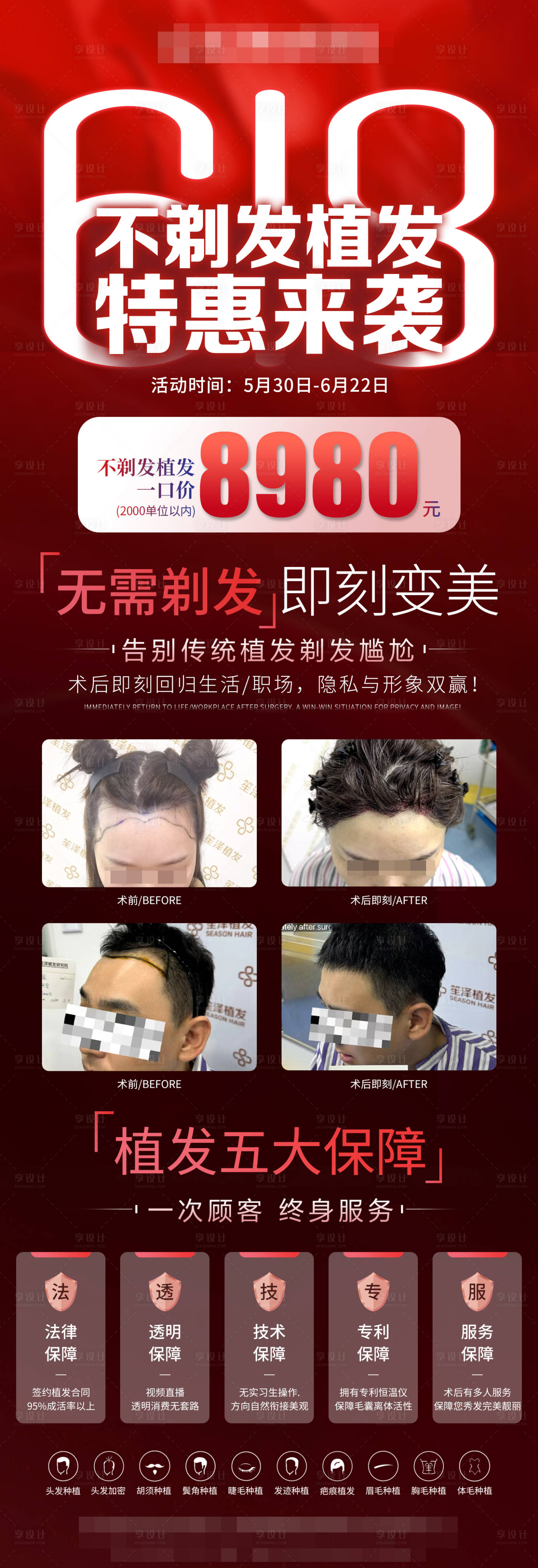 源文件下載【享設計】搜索編號：37360031165017063【醫美618植發活動海報】