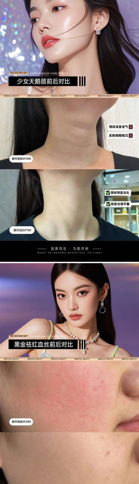 源文件下載【享設計】搜索編號：36600031481573988【醫美案例對比模板】