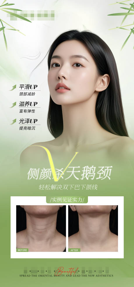 医美天鹅颈对比海报